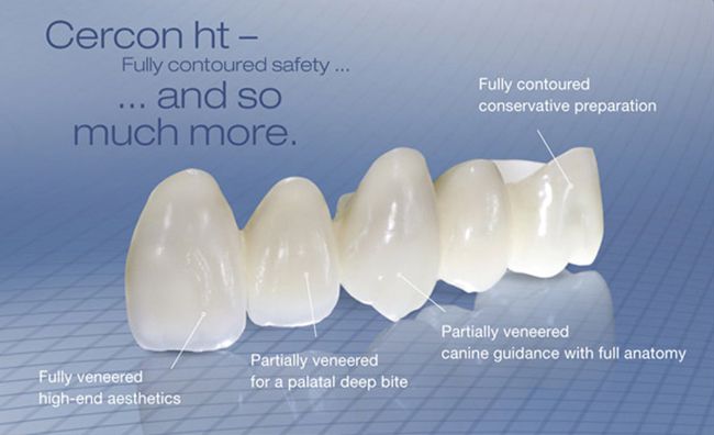 Zirconia-va-rang-su-cercon-2